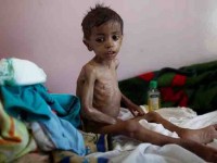 Cientos de niños mueren   a diario de hambruna