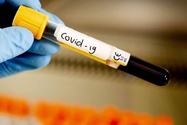 Preocupan casos y muertes por coronavirus en Jalpa