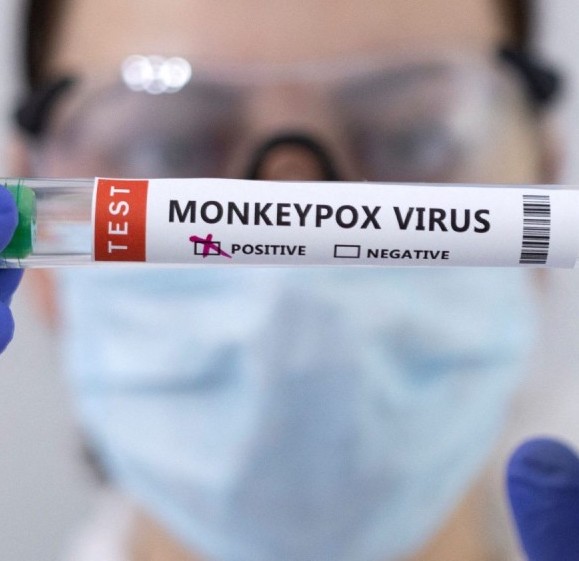OMS reporta 2 mil 103 casos de viruela del mono