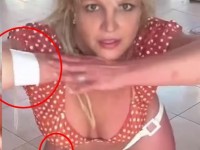 Britney Spears aparece vendada y con heridas