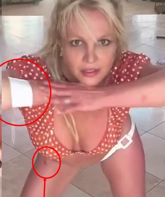 Britney Spears aparece vendada y con heridas