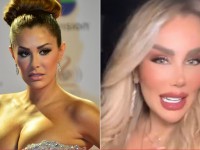 Critican en redes sociales a Ninel Conde por tantas cirugías