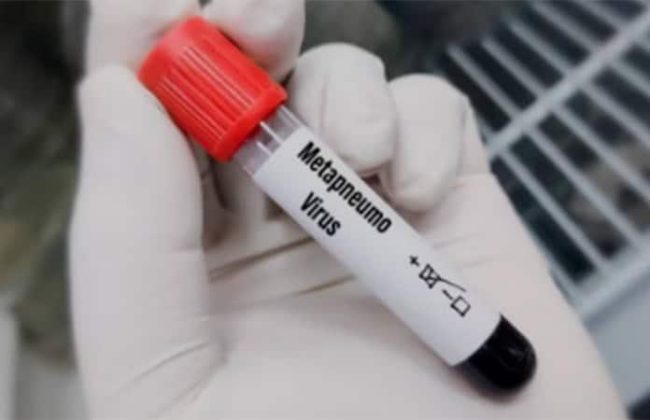 Reportan 150 casos de Metapneumovirus en Sinaloa; no es un riesgo